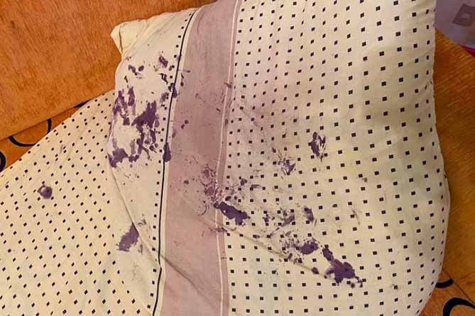 бурые следы на подушке