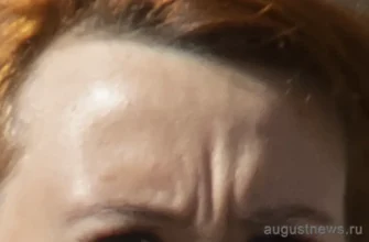 у женщины глубокие морщины между глаз